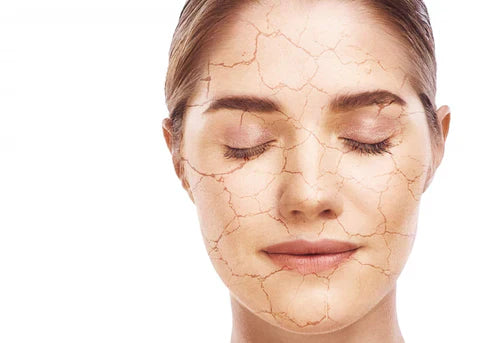 Dry skin - causes and preventive measures